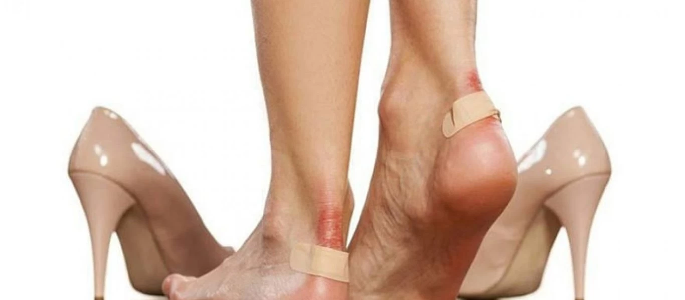 Τα λάθη που κάνετε και επιδεινώνουν τις φουσκάλες στα πόδια